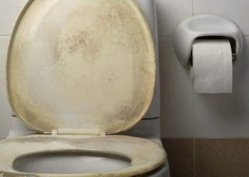 Sararan klozet kapağını beyazlatan pratik yöntem